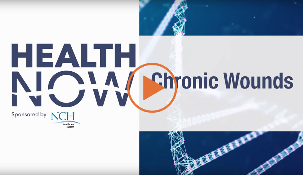 NCH Health Now Chronic Wounds
